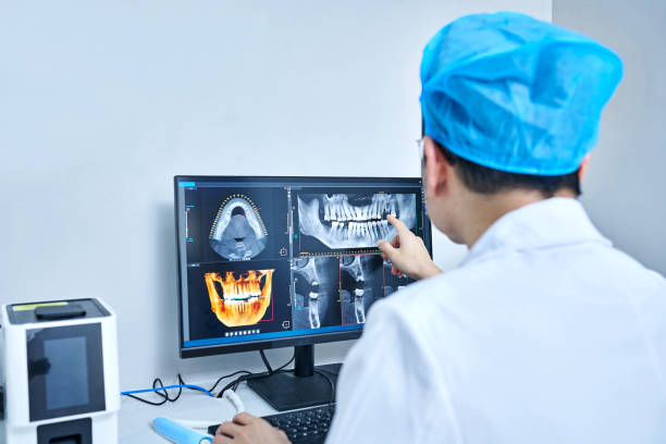 Best Emergency Dental Extractions in Port Reading, NJ
